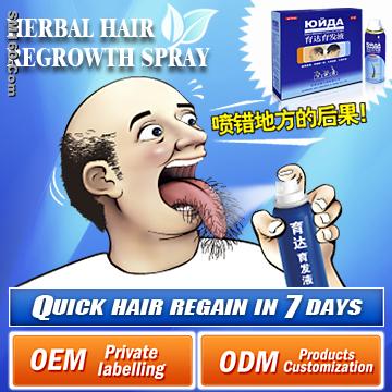 Yuda Pilatory--- Finest strength edition----Quick hair regain in 7 day
