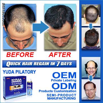 Natural hair growth product, Yuda hair growth spray. 