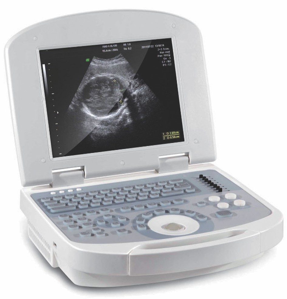 Dolphi PRO Convex Probe Standard B/W Ultrasound Scanner Ce & ISO Approved