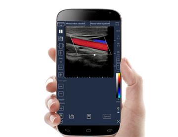 Meditech C-Scan Handheld Touch Screen Color Ultrasound Scanar Ce Approved