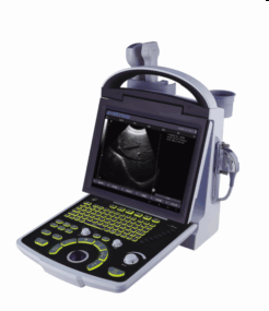 Meditech Ce Approved Ultrasound Scanner with PC Platform