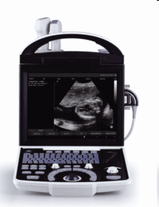 Meditech Ce Approved Ultrasound Scanner with PC Platform